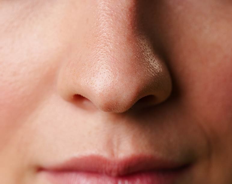 Dr Fawzy Zoomed Nose