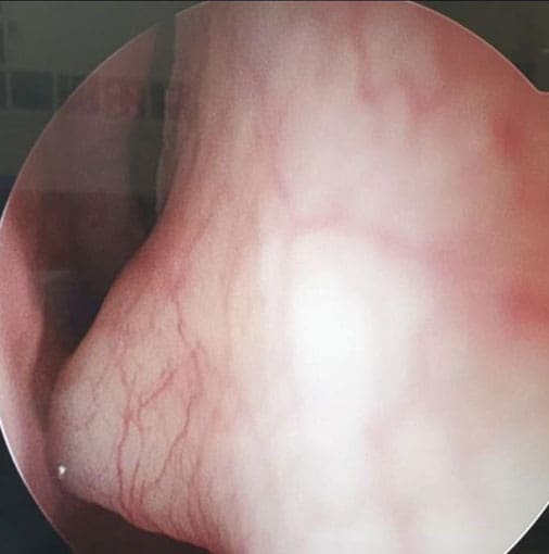 Dr Fawzy - Deviated Septum Image 1