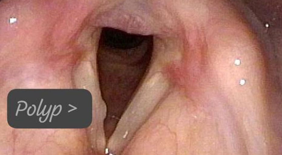 Dr Fawzy - Flexible Laryngoscopy Image 2