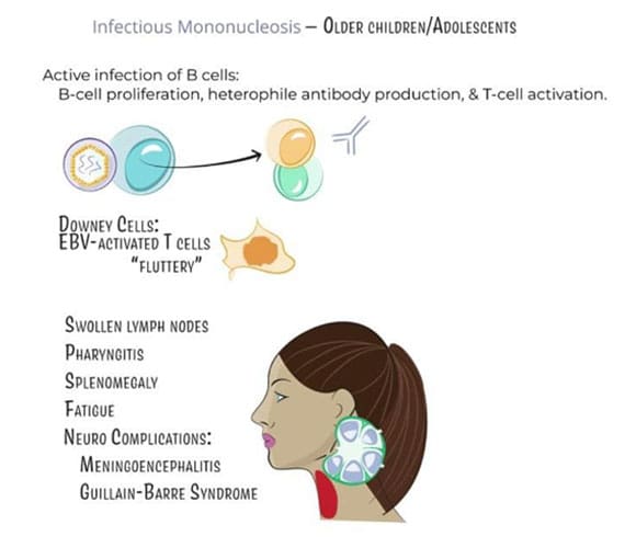 Dr Fawzy - Glandular Fever Image 1