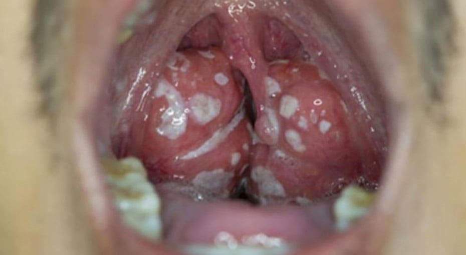Dr Fawzy - Glandular Fever Image 2