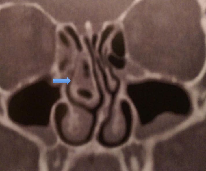 Dr Fawzy - Headache Image 1