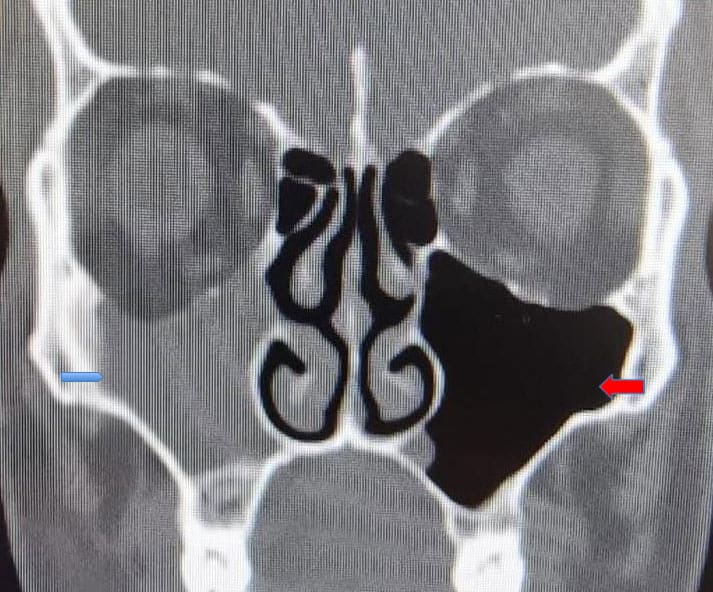 Dr Fawzy - Headache Image 2