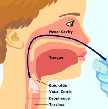 Dr Fawzy - Flexible Laryngoscopy Image 1
