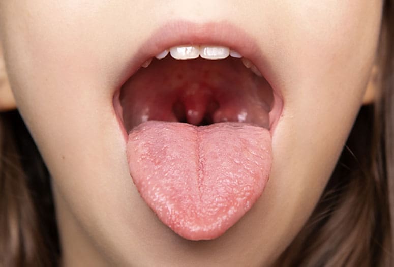 Dr Tamer Fawzy - Tonsillitis Landing