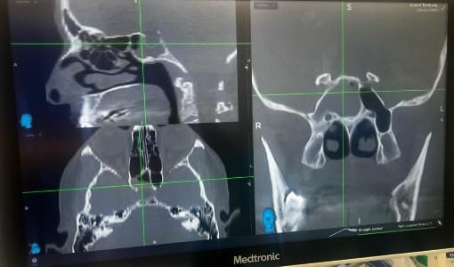 Image Guided Sinus Surgery Content Imagery Dr T