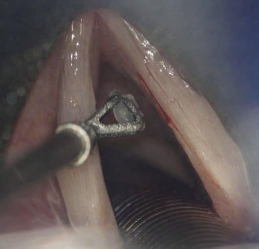 Polyp Content Imagery Dr T