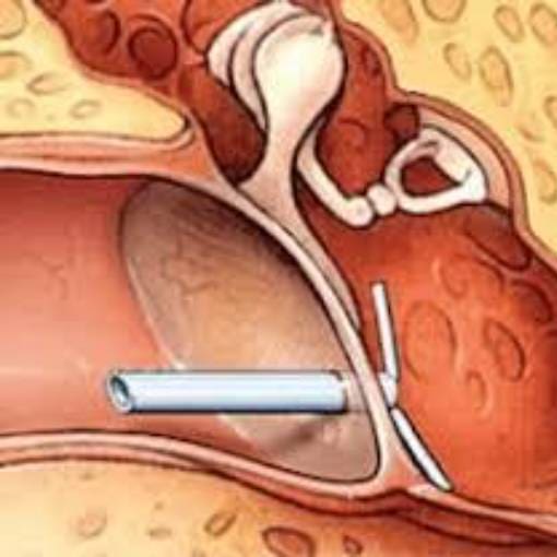 T Tube Content Imagery Dr T