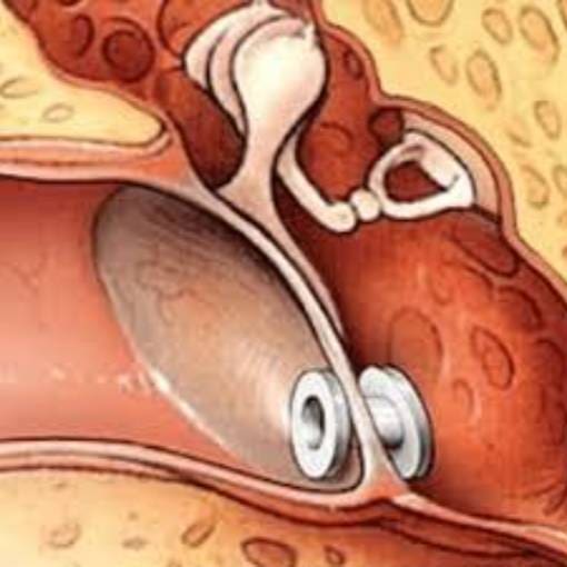 T Tube Content Imagery Dr T