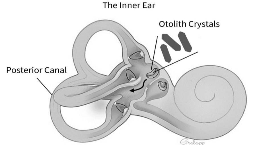 Vertigo Maneuvres Content Imagery DrT